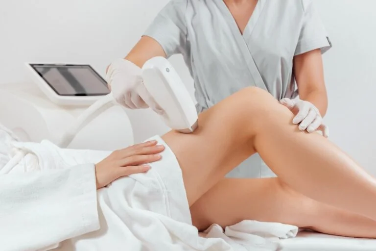 laser hair removal in etobicoke on