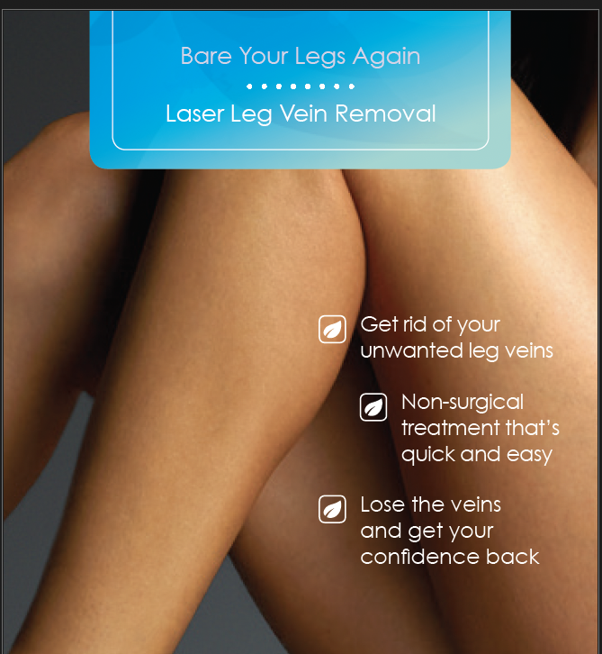 laser-vein-removal-in-etobicoke