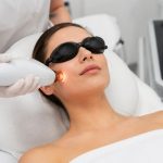Top benefits of laser facials for acne scars