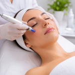 What Is Microneedling A Complete Beginner’s Guide